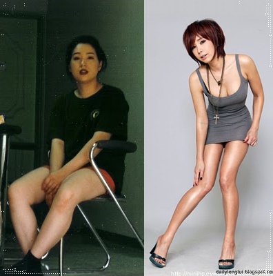 Jung Dae Yeonn prima e dopo 2